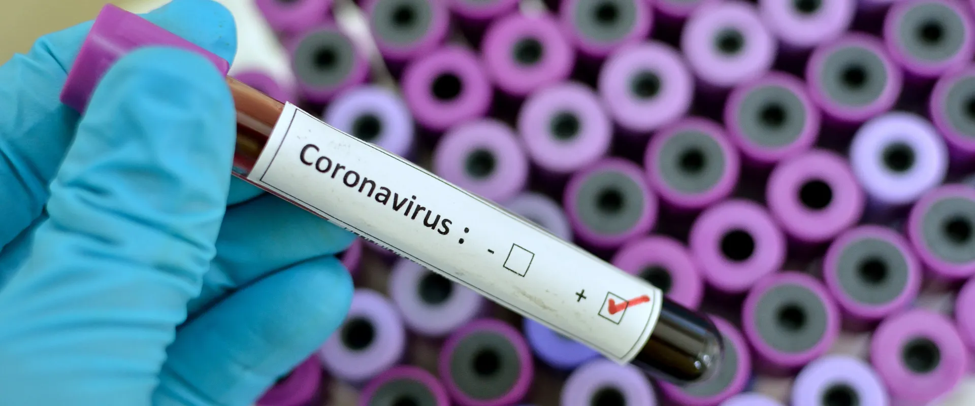 10 tény a koronavírussal kapcsolatban, amit érdemes tudni